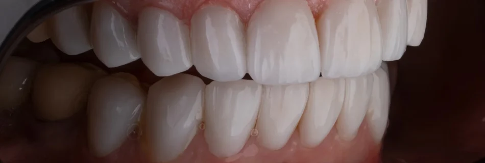 tratamientos dentales en san jose